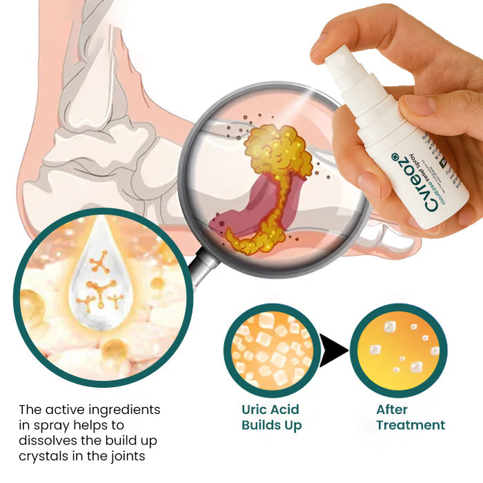 🔥Hot Sales - 50% OFF🔥Cvreoz® GoutEase Relief Spray