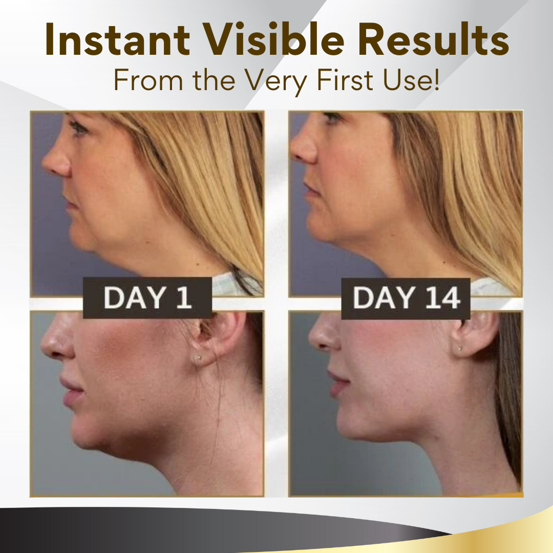 VSlim™ Bee Venom Slimming Mask