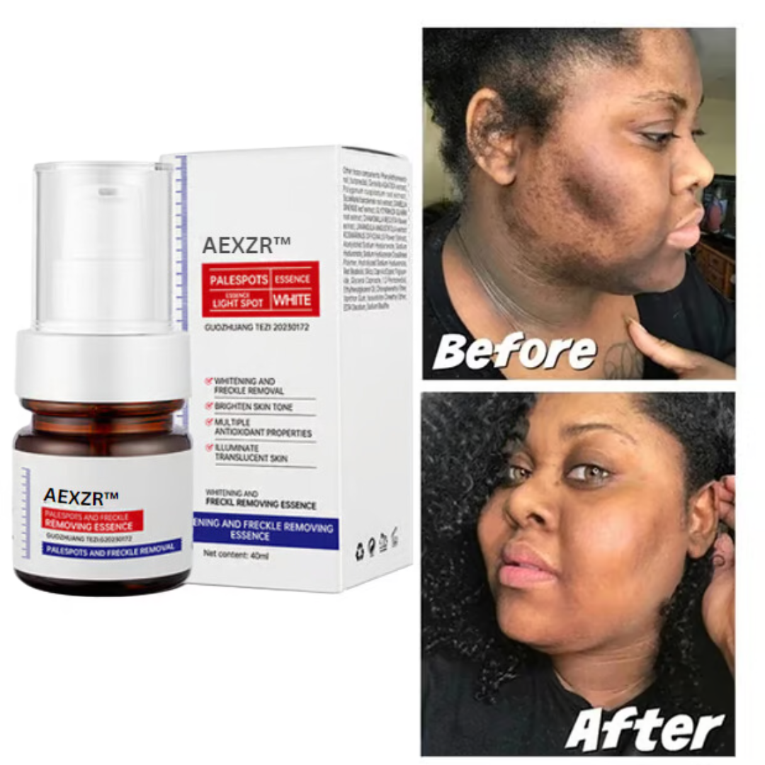 🔥 AEXZR™ Vitamin C Whitening Freckles Face Cream Remove Melasma Dark Spots Lighten Melanin