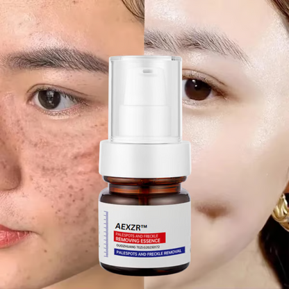 🔥 AEXZR™ Vitamin C Whitening Freckles Face Cream Remove Melasma Dark Spots Lighten Melanin