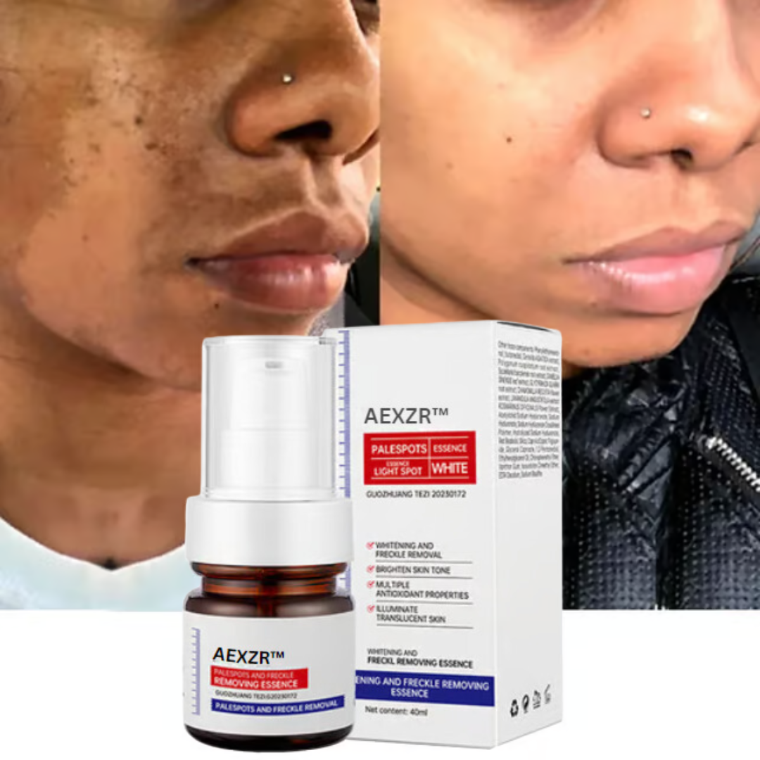 🔥 AEXZR™ Vitamin C Whitening Freckles Face Cream Remove Melasma Dark Spots Lighten Melanin