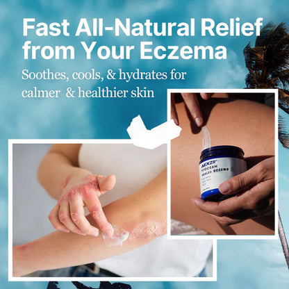 AEXZR™  Ocean Healed  Eczema Soothing Cream