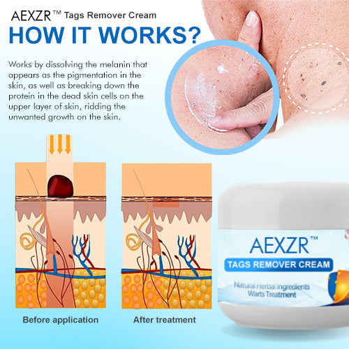 AEXZR™  Tags Remover Cream